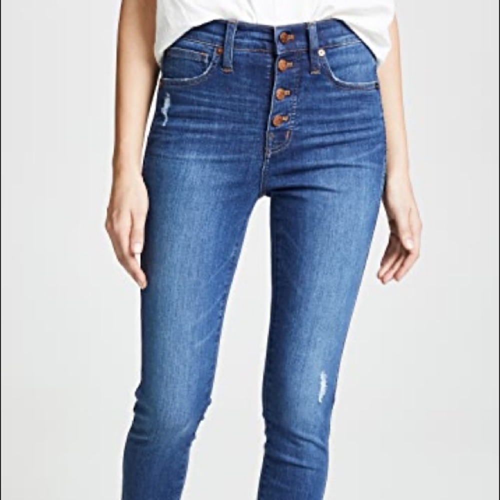 Madewell button-fly skinny jeans